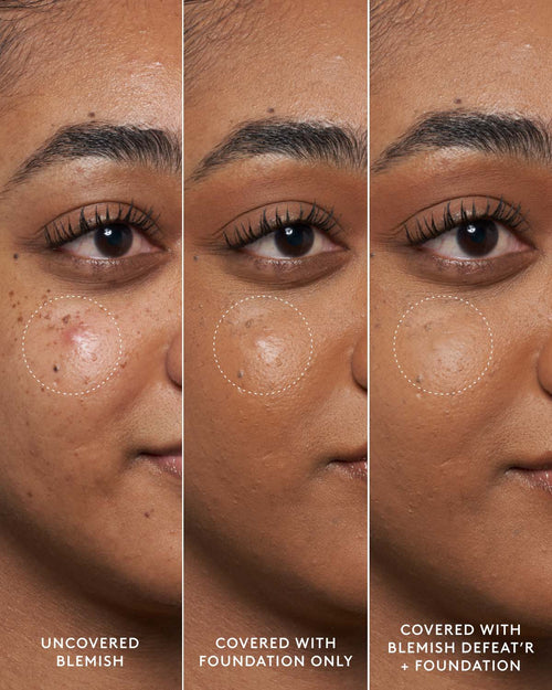 Blemish Defeat'r BHA Spot-Targeting Gel